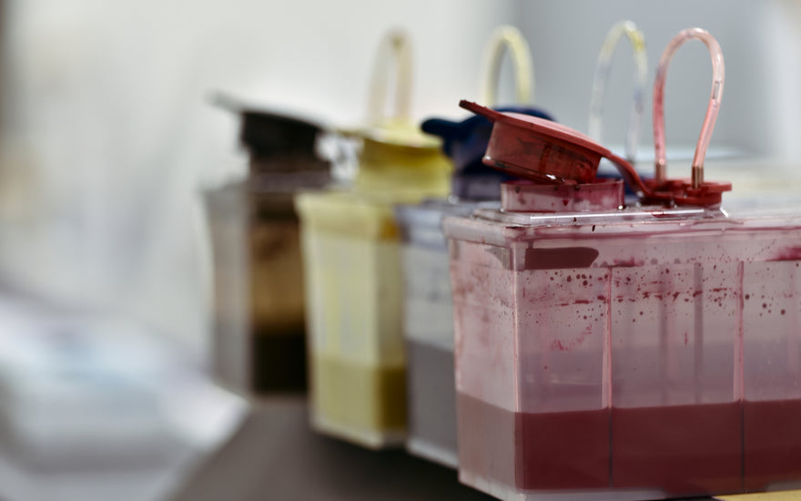 Pros and Cons of Dye Sublimation